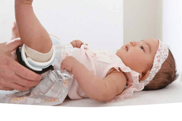 Denis Browne Hip Brace (DBB)